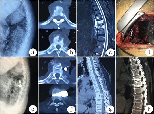 Best Spine Surgery Hospital in Kerala