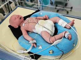 Baby Lung Simulator