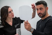 Hair loss solutions Chicago