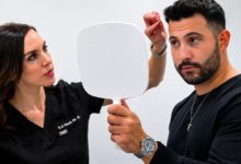 Best FUE clinic in Chicago