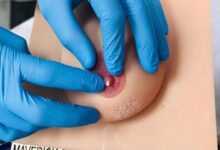 Single Breast Trainer