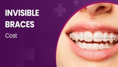 Invisible Braces Cost in Pune