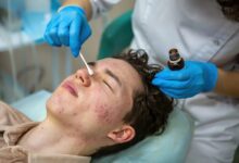 Acne Scar Treatment in Mumbai