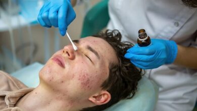 Acne Scar Treatment in Mumbai