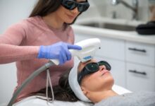 Best Laser Treatments in Chicago