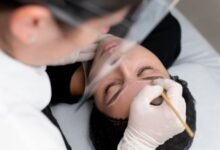 Eyebrow Transplant Chicago