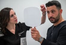 FUE hair transplant near me