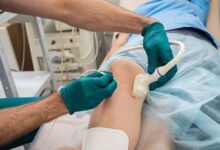 Radiofrequency Ablation near Me