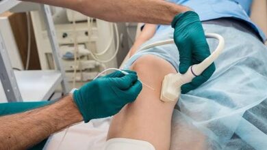 Radiofrequency Ablation near Me