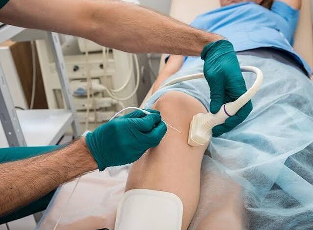 Radiofrequency Ablation near Me