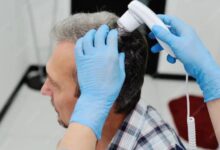 Exosomes Treatment​