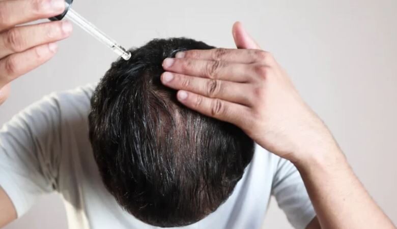 Gfc Hair Treatment​