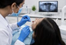 Invisible Aligners in Kondapur